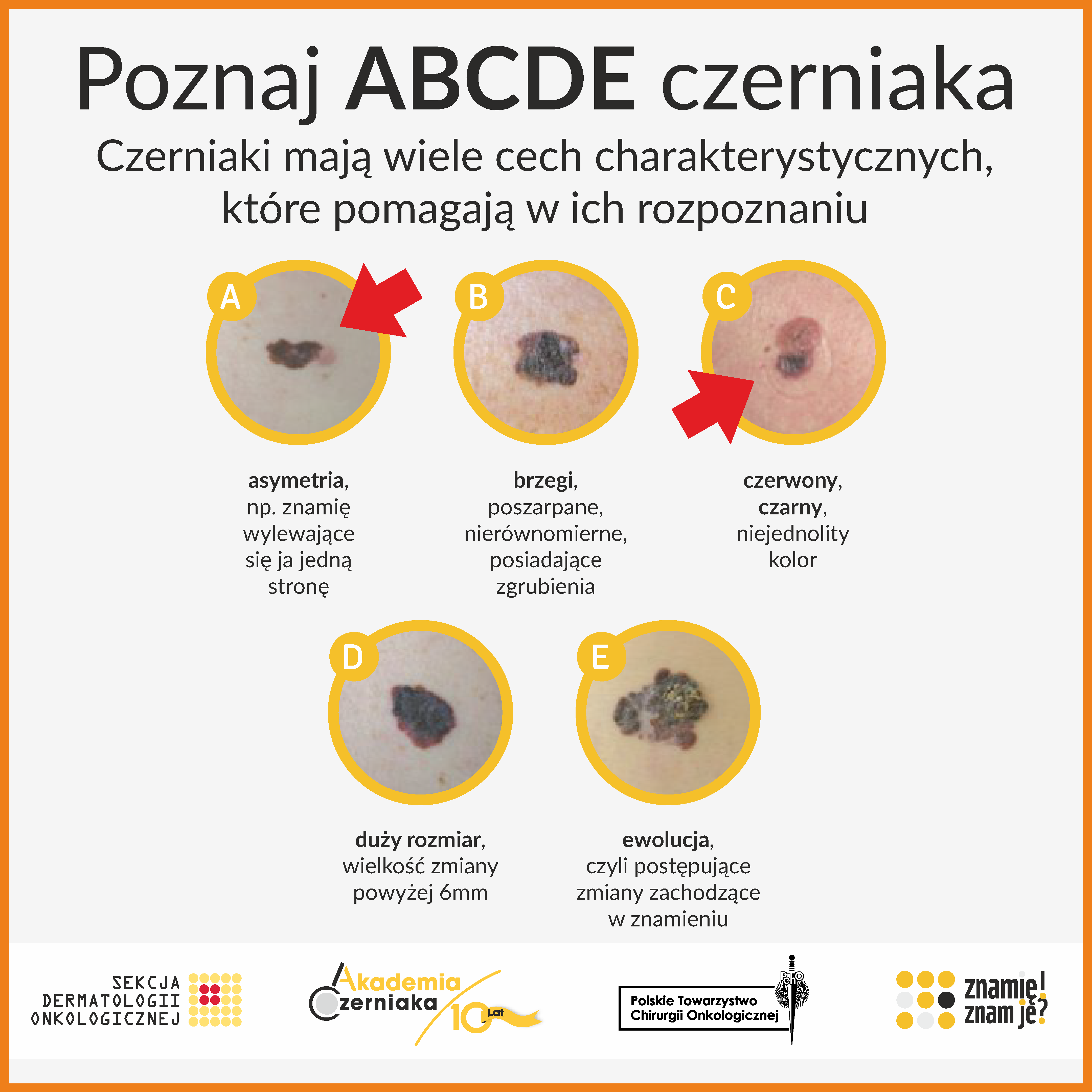 OGÓLNOPOLSKI PROGRAM PROFILAKTYKI CZERNIAKA
